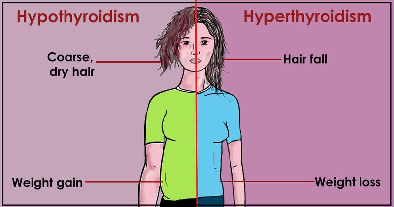 Hyperthyroidism and Hyporthyroidism